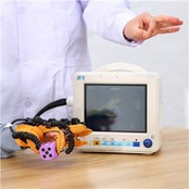 Yuqori oyoq-qo'llarni mashq qilish robot tizimi